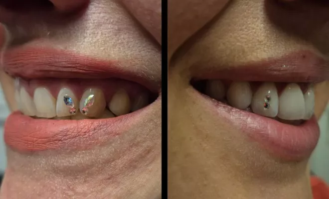 Piercing visage, Le Thillot, Taïga Zore Art Tattoo